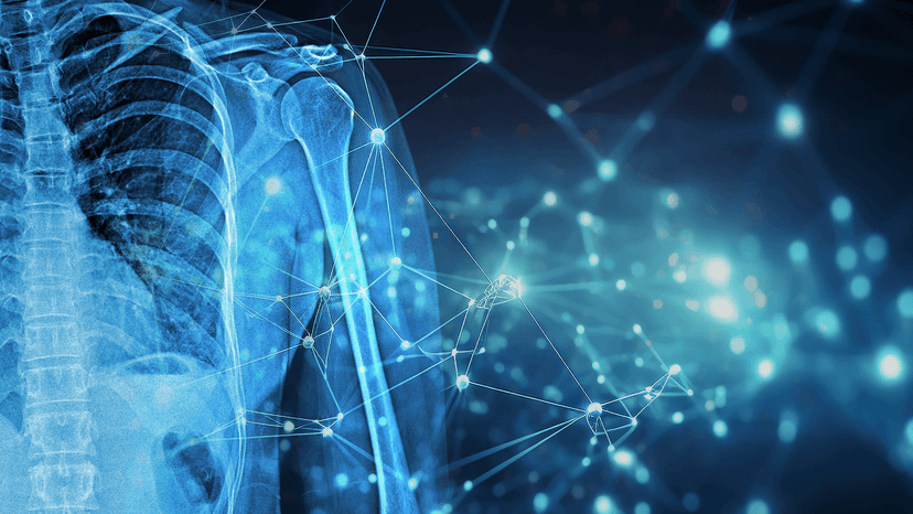 Dell AI on CPUs A PoC for Healthcare